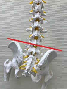 腰椎椎間板ヘルニア豊洲