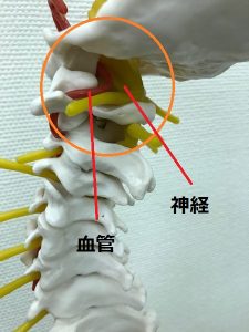 目まい血管プラーク豊洲